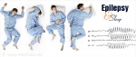 4 dạng động kinh thường xuất hiện trong giấc ngủ