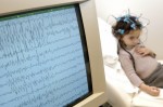 Cách chẩn đoán bệnh động kinh ở trẻ dưới 1 tuổi nhanh và chính xác nhất