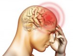 Chấn thương sọ não nguy cơ cao dẫn đến các cơn co giật, động kinh