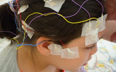 Có nên can thiệp bằng phẫu thuật ở trẻ mắc bệnh động kinh?