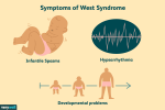Động kinh ở dạng hội chứng west gây chứng động kinh co thắt cơ ở trẻ em