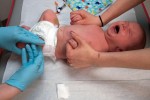 Hiện tượng co giật ở trẻ sơ sinh và cách điều trị